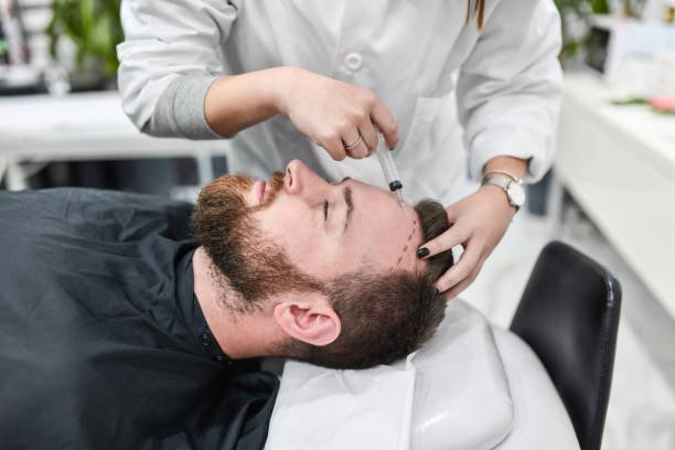 Best Permanent Hair Transplant in Karachi: Fees and Reviews for Females