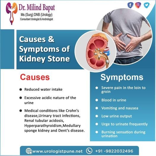 Top Kidney Stone Specialist in Pune: Dr. Milind Bapat