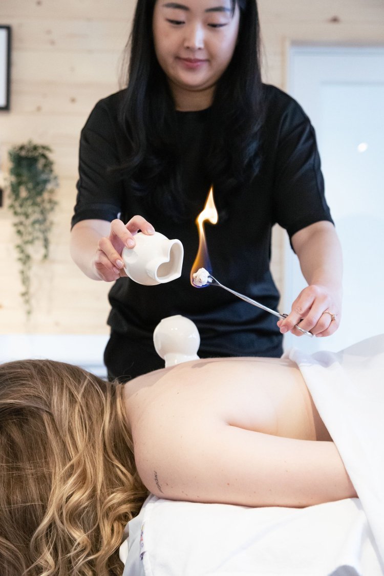 Unlocking Wellness Through Acupuncture in Vancouver: Traditional Healing with New Moon Massage and Wellness