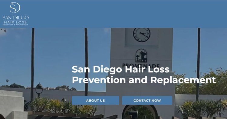 Nonsurgical Hair Replacement in San Diego: A Complete Guide to Restoring Confidence