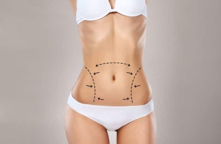 The Best Liposuction Surgeons in Dubai: Patient Safety and Professionalism