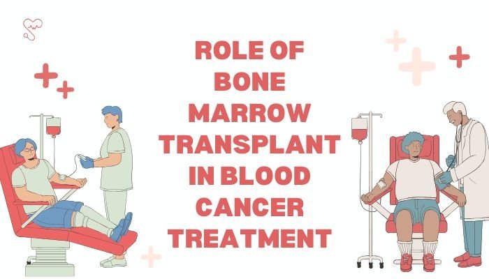 Role Of Bone Marrow Transplant In Blood Cancer Treatment