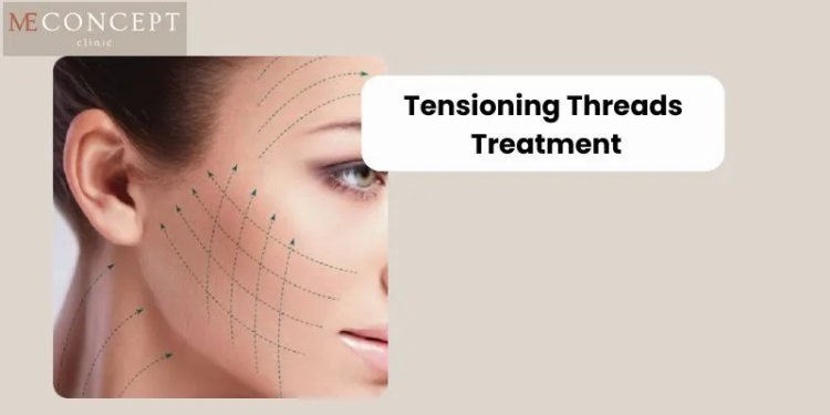 7 Key Benefits of Choosing Tensioning Threads Treatment For A Youthful Look