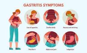 Gastrointestinal Issues: Causes, Symptoms, and Effective Remedies