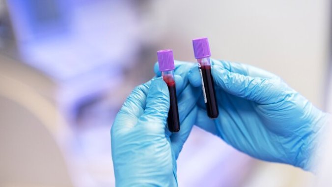 Who Should Get an IgE Blood Test? Key Symptoms and Risk Factors