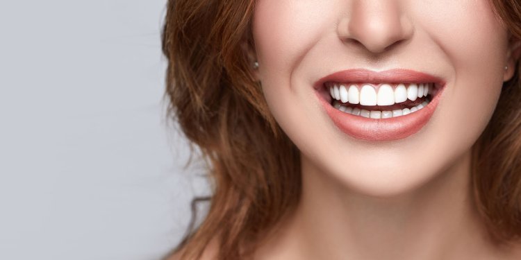 How a Smile Makeover Can Enhance Your Appearance?