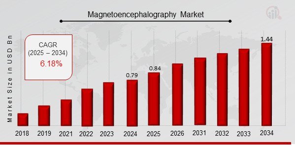 Mapping the Brain: Advancements in Magnetoencephalography (MEG)